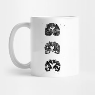 Alzheimer's Disease Mug